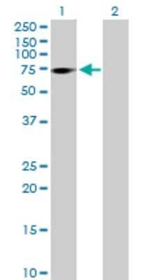 Western Blot: ZNF571 Antibody [H00051276-B01P]