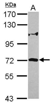 Western Blot: ZNF571 Antibody [NBP2-15176]