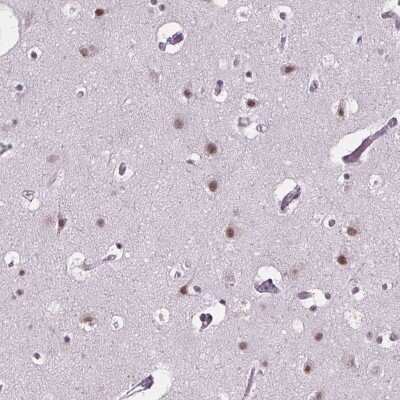 Immunohistochemistry: ZNF572 Antibody [NBP2-39077]