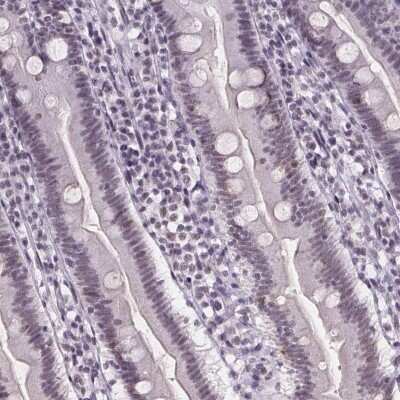 Immunohistochemistry-Paraffin: ZNF572 Antibody [NBP2-39077]