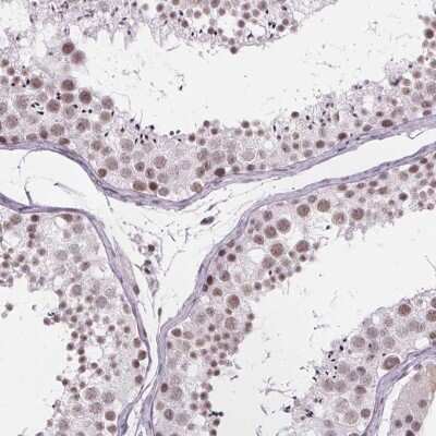 Immunohistochemistry-Paraffin: ZNF572 Antibody [NBP2-39077]