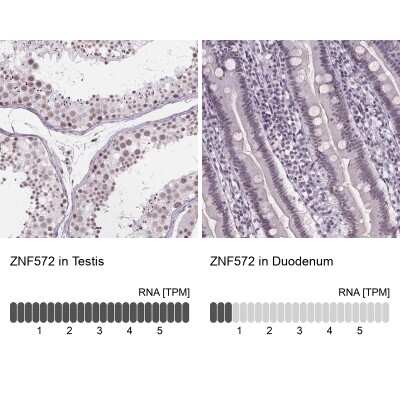 Immunohistochemistry-Paraffin: ZNF572 Antibody [NBP2-39077]
