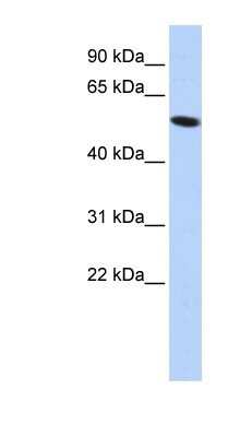 Western Blot: ZNF572 Antibody [NBP1-80157]