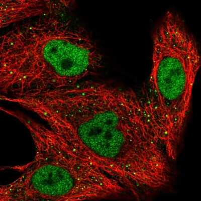 Immunocytochemistry/ Immunofluorescence: ZNF574 Antibody [NBP2-58548]