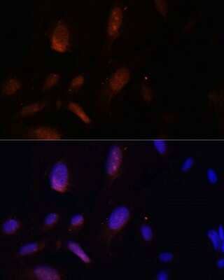 Immunocytochemistry/ Immunofluorescence: ZNF574 Antibody - Azide and BSA Free [NBP3-04776]