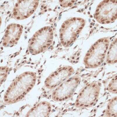 Immunohistochemistry-Paraffin: ZNF574 Antibody - Azide and BSA Free [NBP3-04776]