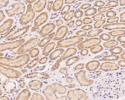 Immunohistochemistry-Paraffin: ZNF574 Antibody [NBP3-12605]