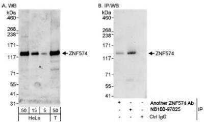 Western Blot: ZNF574 Antibody [NB100-97825]