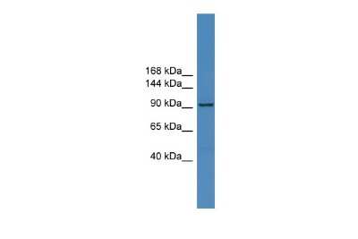 Western Blot: ZNF574 Antibody [NBP2-88711]