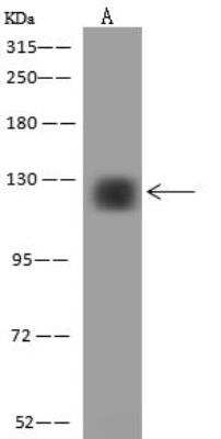 Western Blot: ZNF574 Antibody [NBP3-12605]