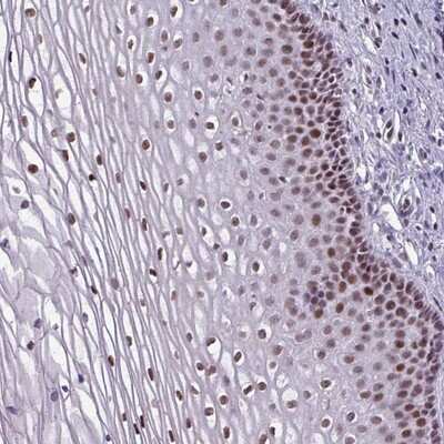 Immunohistochemistry-Paraffin: ZNF575 Antibody [NBP2-13583]