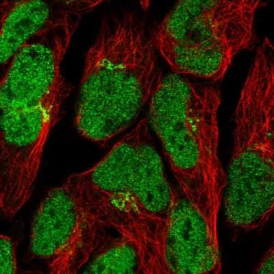 Immunocytochemistry/ Immunofluorescence: ZNF576 Antibody [NBP2-13584]