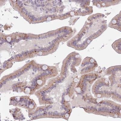 Immunohistochemistry-Paraffin: ZNF576 Antibody [NBP2-13584]