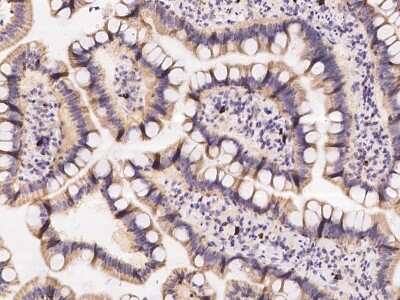 Immunohistochemistry-Paraffin: ZNF576 Antibody [NBP2-97980]
