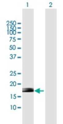 Western Blot: ZNF576 Antibody [H00079177-B01P]