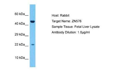 Western Blot: ZNF576 Antibody [NBP2-86521]