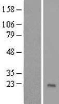 Western Blot: ZNF576 Overexpression Lysate [NBL1-18194]