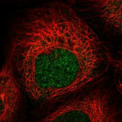 Immunocytochemistry/ Immunofluorescence: ZNF577 Antibody [NBP2-31026]