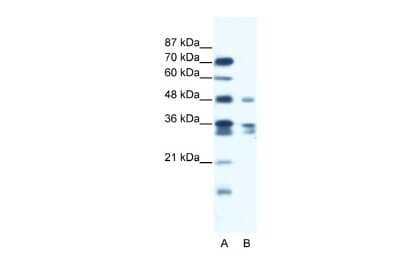 Western Blot: ZNF577 Antibody [NBP2-86522]