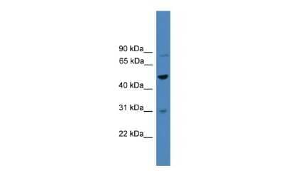 Western Blot: ZNF577 Antibody [NBP2-86524]