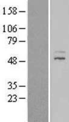 Western Blot: ZNF577 Overexpression Lysate [NBL1-18195]