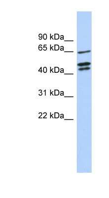 Western Blot: ZNF578 Antibody [NBP1-79370]