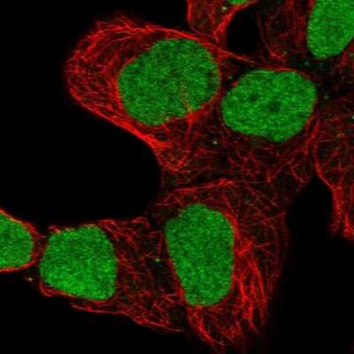 Immunocytochemistry/ Immunofluorescence: ZNF579 Antibody [NBP2-38973]