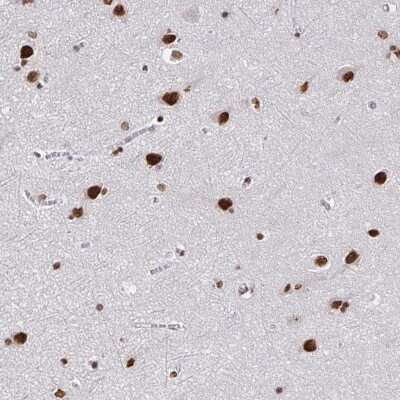 Immunohistochemistry-Paraffin: ZNF579 Antibody [NBP2-38973]