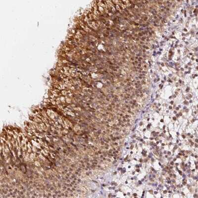 Immunohistochemistry-Paraffin: ZNF580 Antibody [NBP2-47565]