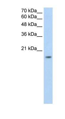Western Blot: ZNF580 Antibody [NBP1-80333]