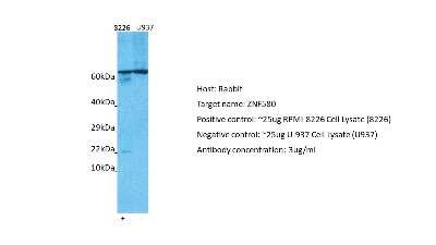 Western Blot: ZNF580 Antibody [NBP1-80333]