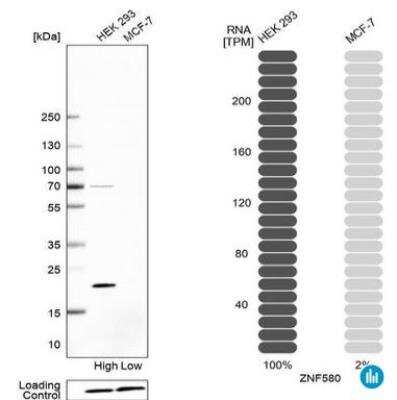 Western Blot: ZNF580 Antibody [NBP2-47565]