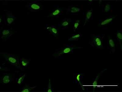 Immunocytochemistry/ Immunofluorescence: ZNF582 Antibody [H00147948-B01P]