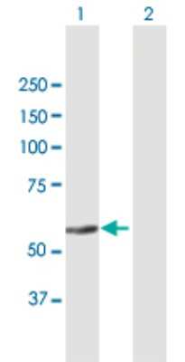 Western Blot: ZNF582 Antibody [H00147948-B01P]