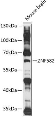 Western Blot: ZNF582 AntibodyAzide and BSA Free [NBP3-05012]