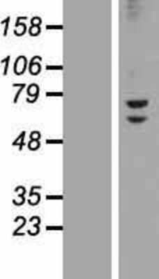 Western Blot: ZNF582 Overexpression Lysate [NBP2-05537]