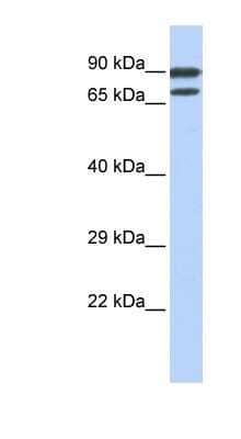 Western Blot: ZNF583 Antibody [NBP1-80162]