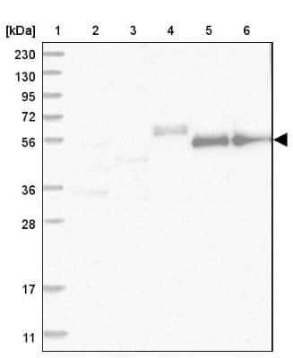 Western Blot: ZNF583 Antibody [NBP2-48570]