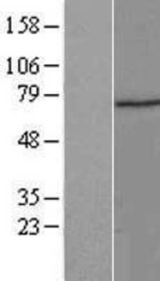 Western Blot: ZNF583 Overexpression Lysate [NBP2-05367]