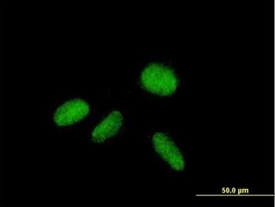 Immunocytochemistry/ Immunofluorescence: ZNF584 Antibody [H00201514-B01P]