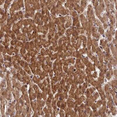 Immunohistochemistry: ZNF584 Antibody [NBP2-47564]