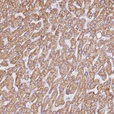 Immunohistochemistry: ZNF584 Antibody [NBP2-48887]