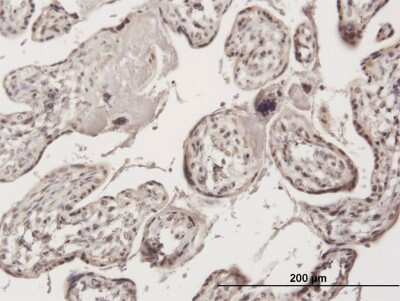 Immunohistochemistry-Paraffin: ZNF584 Antibody [H00201514-B01P]
