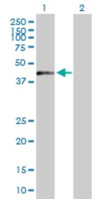 Western Blot: ZNF584 Antibody [H00201514-B01P]