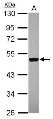 Western Blot: ZNF584 Antibody [NBP2-21029]