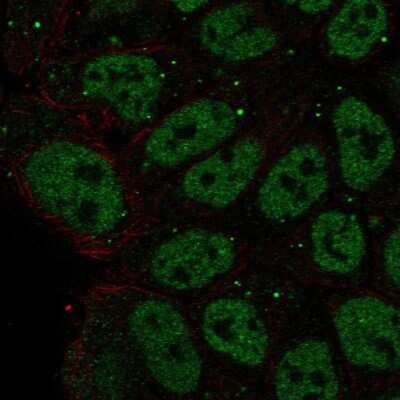 Immunocytochemistry/ Immunofluorescence: ZNF585B Antibody [NBP2-58014]