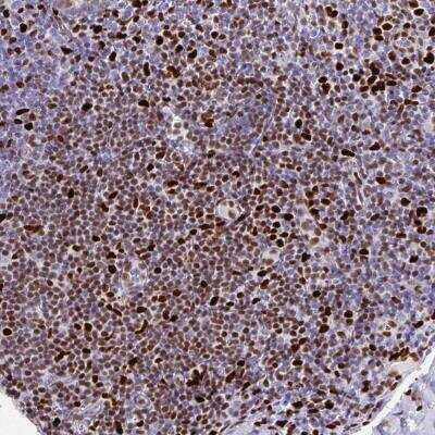 Immunohistochemistry-Paraffin: ZNF586 Antibody [NBP2-31839]