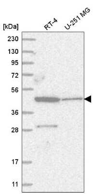 Western Blot: ZNF586 Antibody [NBP2-56434]