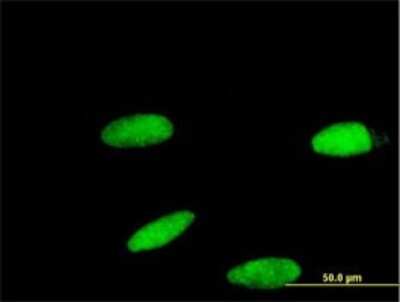 Immunocytochemistry/ Immunofluorescence: ZNF587 Antibody (3A3) [H00084914-M01]