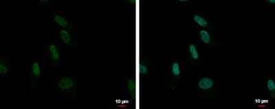 Immunocytochemistry/ Immunofluorescence: ZNF587 Antibody [NBP2-21031]